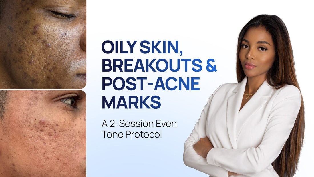 HydroDiamond + Cold Plasma: A Protocol for Oily Skin with Post-Inflammatory Hyperpigmentation
