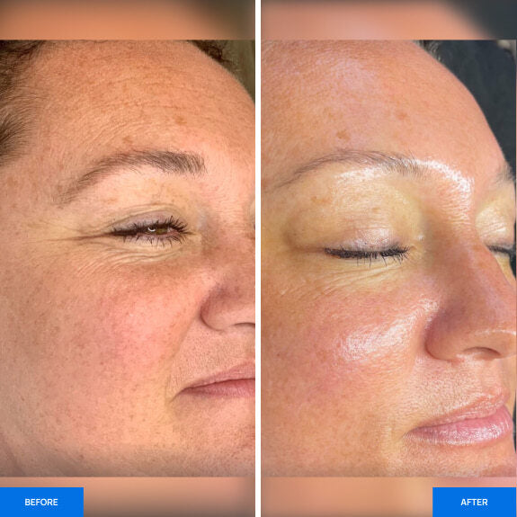 Before After Slide 1