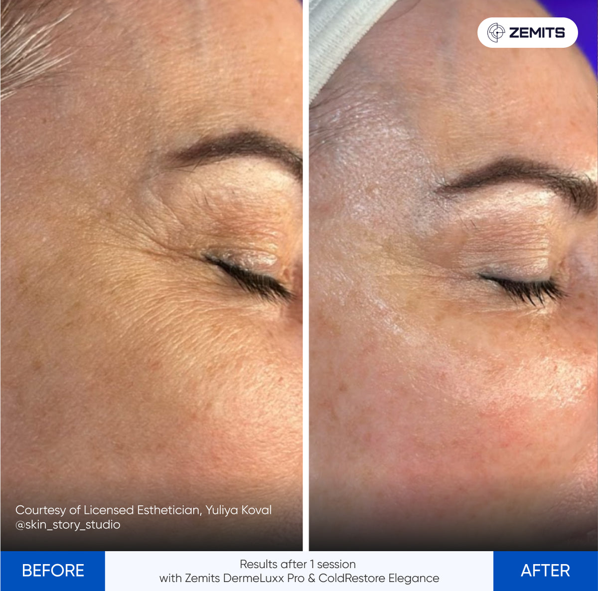 Before After Slide 7