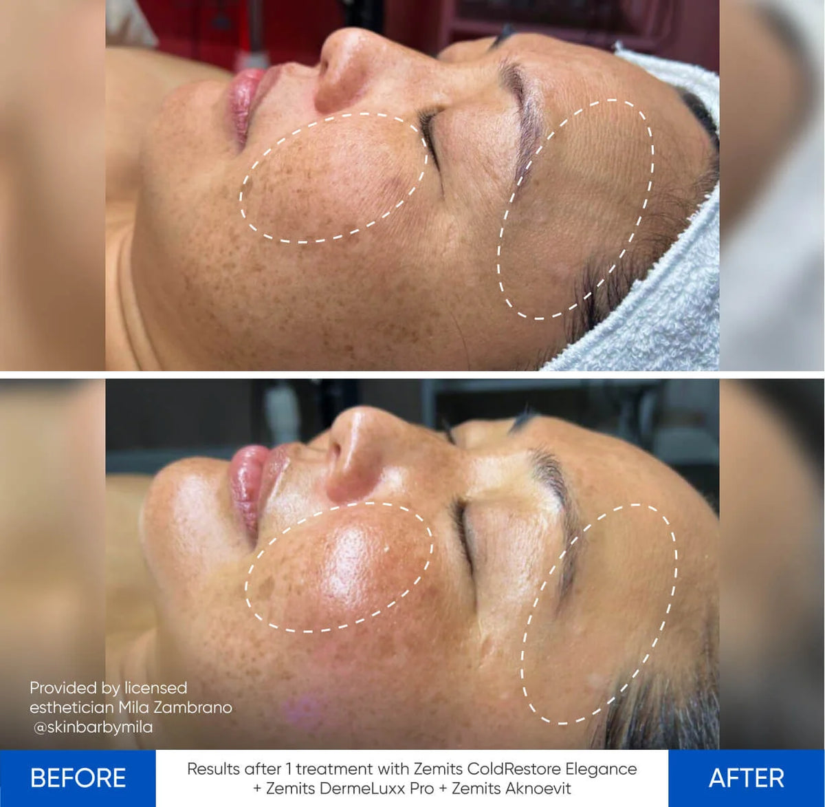 Before After Slide 5